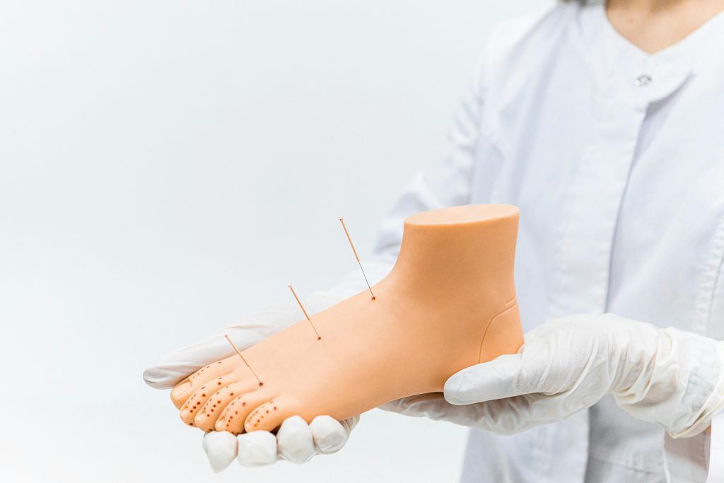 A medical practitioner demonstrates acupuncture on a foot model, highlighting needle placement.