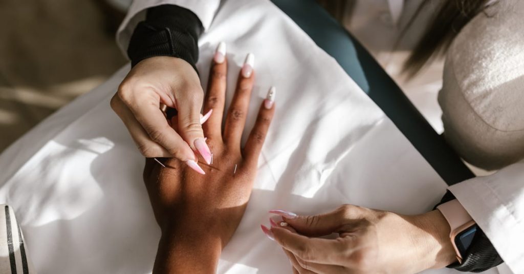 Close-up of hands during an acupuncture therapy session for holistic health and wellness.